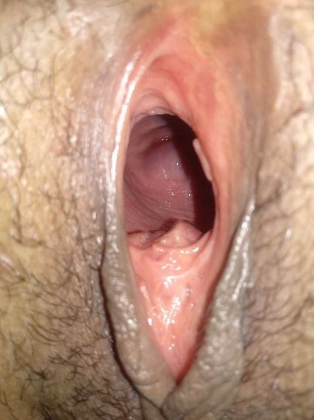 cervix needs the cream