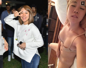 Asian before and after