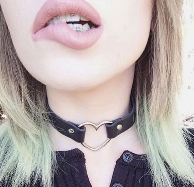 Braces lip bite