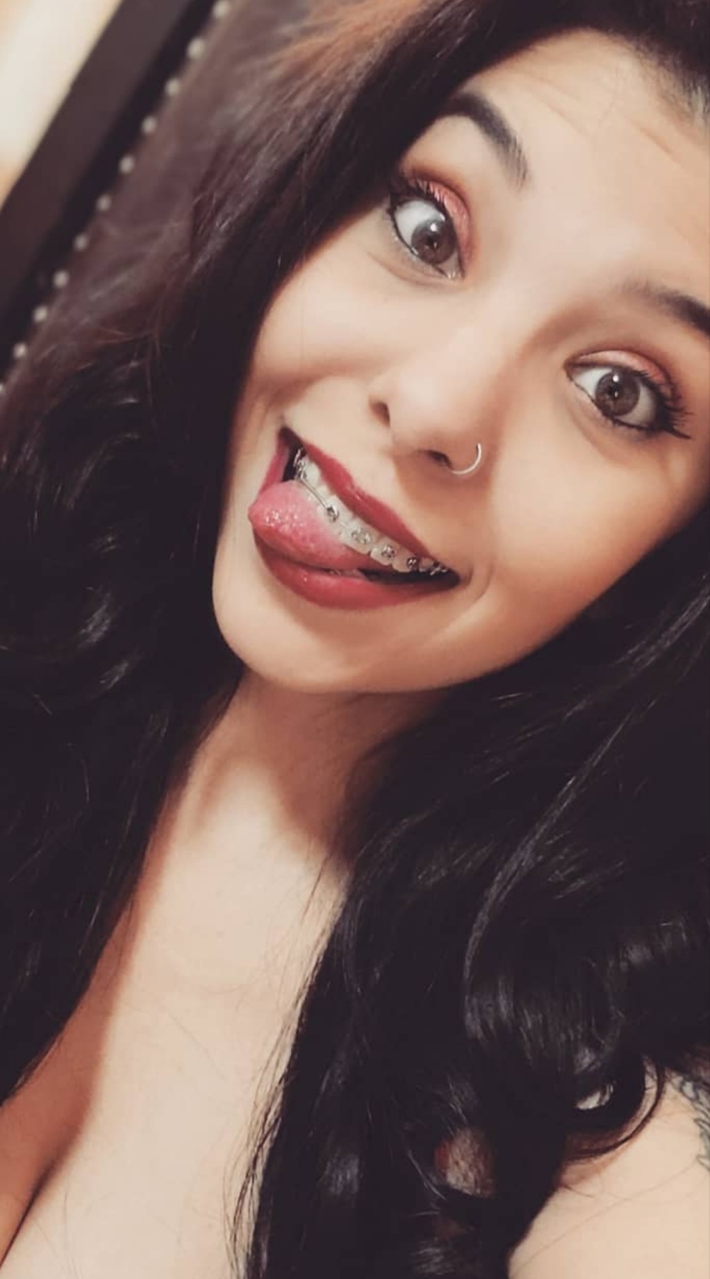 Braces tongue