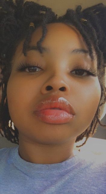 Lips poppin