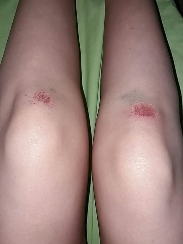 What happened at the party 2. Ops