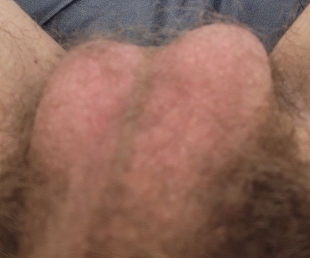 My balls :)