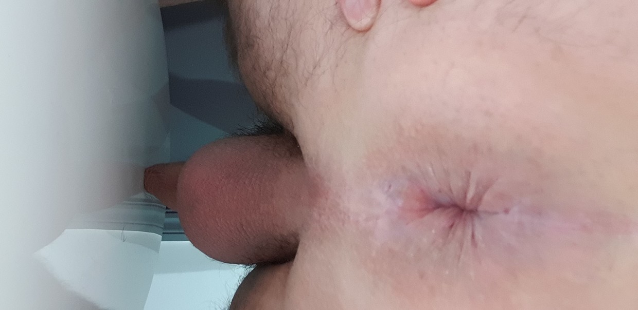 shaved my asshole