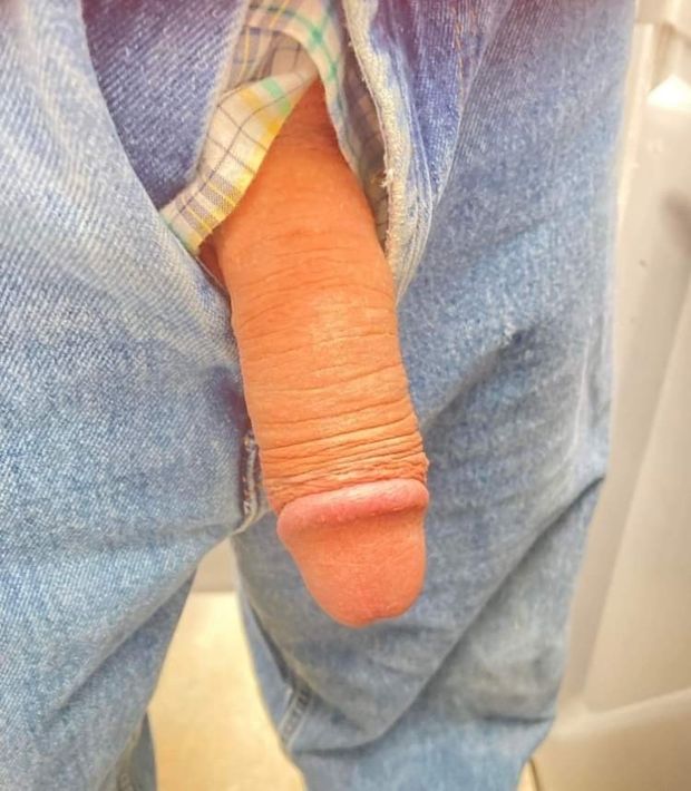 Dick