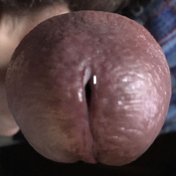 Cockhead
