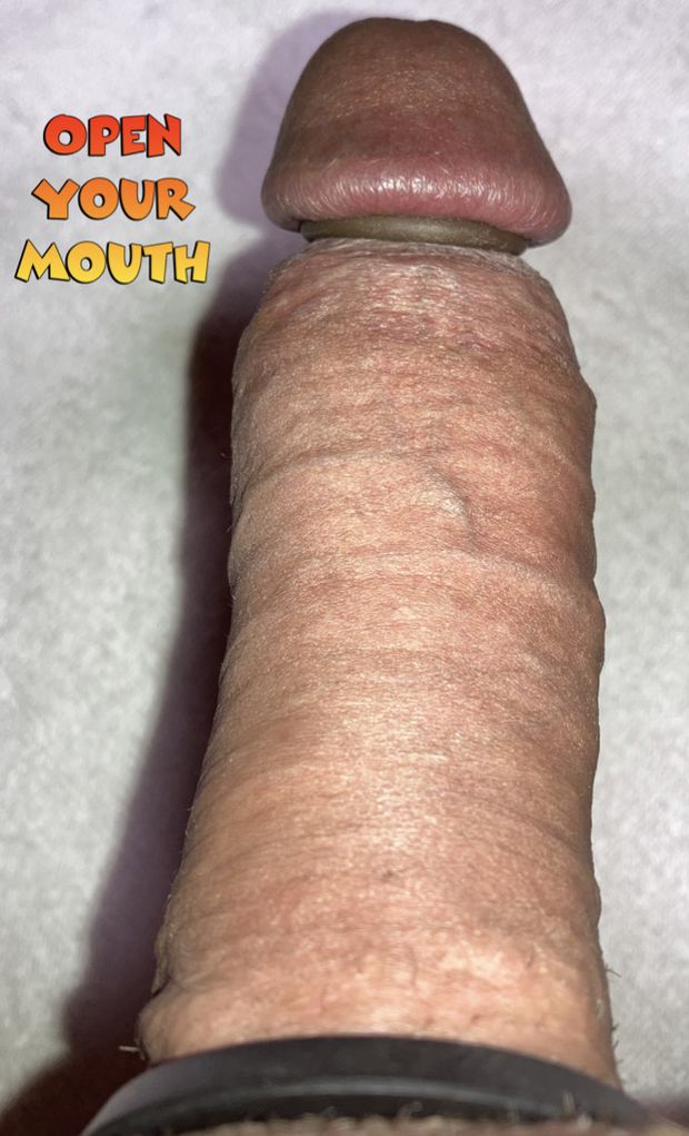 Open your mouth