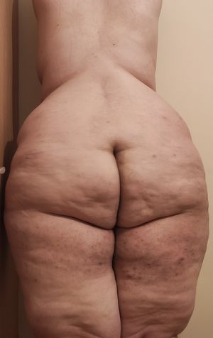 One more of my fat ass