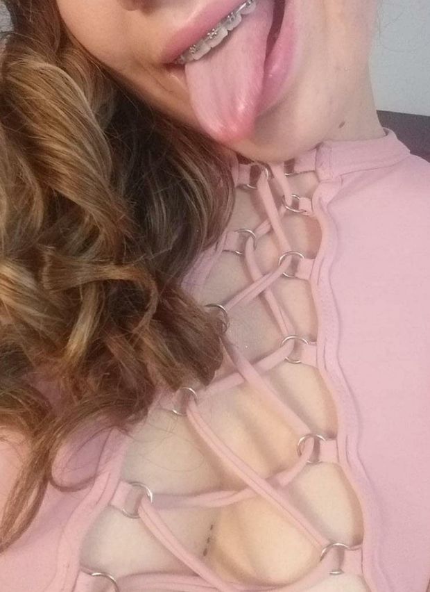 Braces