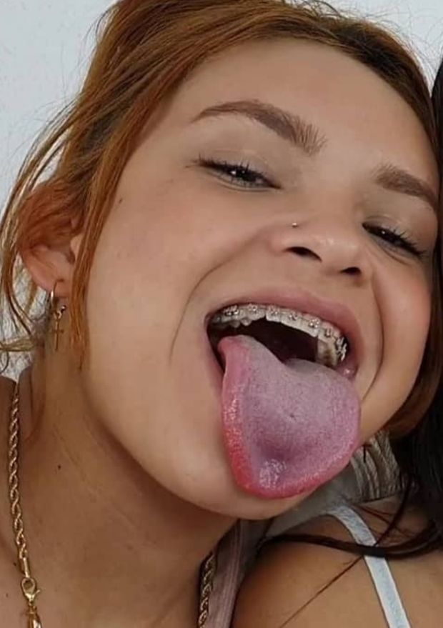 Braces latina