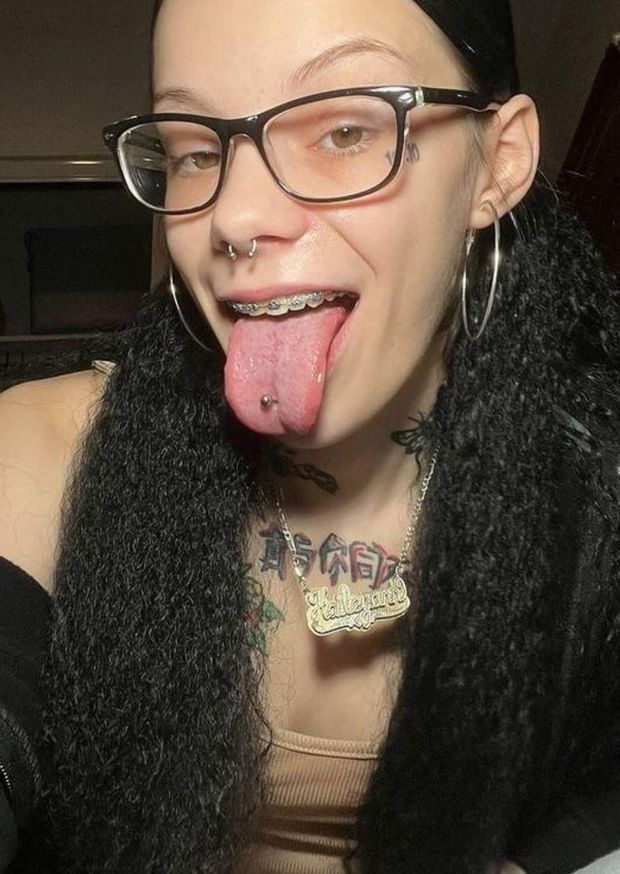 Braces glasses