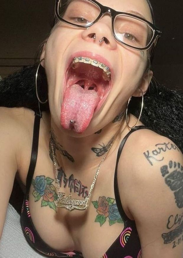 Braces glasses