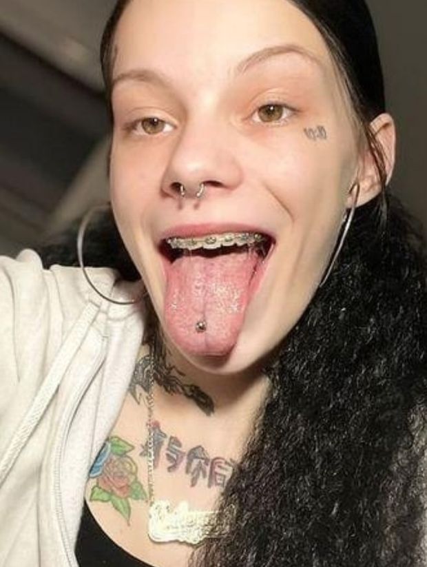 Braces piercing