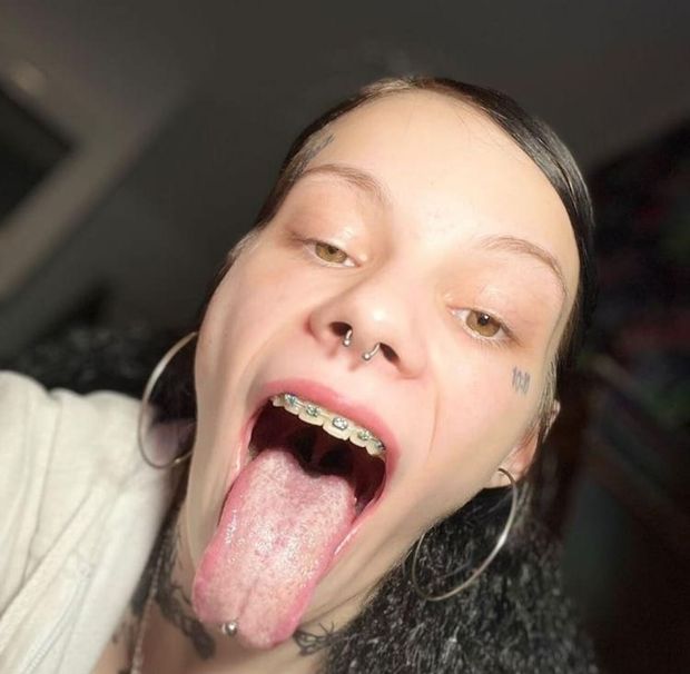 Braces piercing