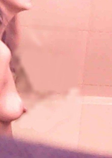 Hidden nipples