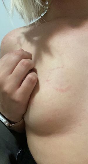 Bite marks from Daddy to remind me I was a good little slut