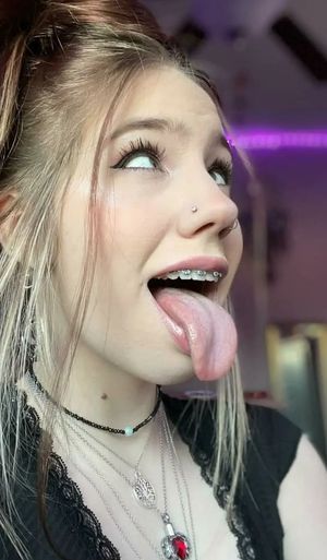 Braces tongue