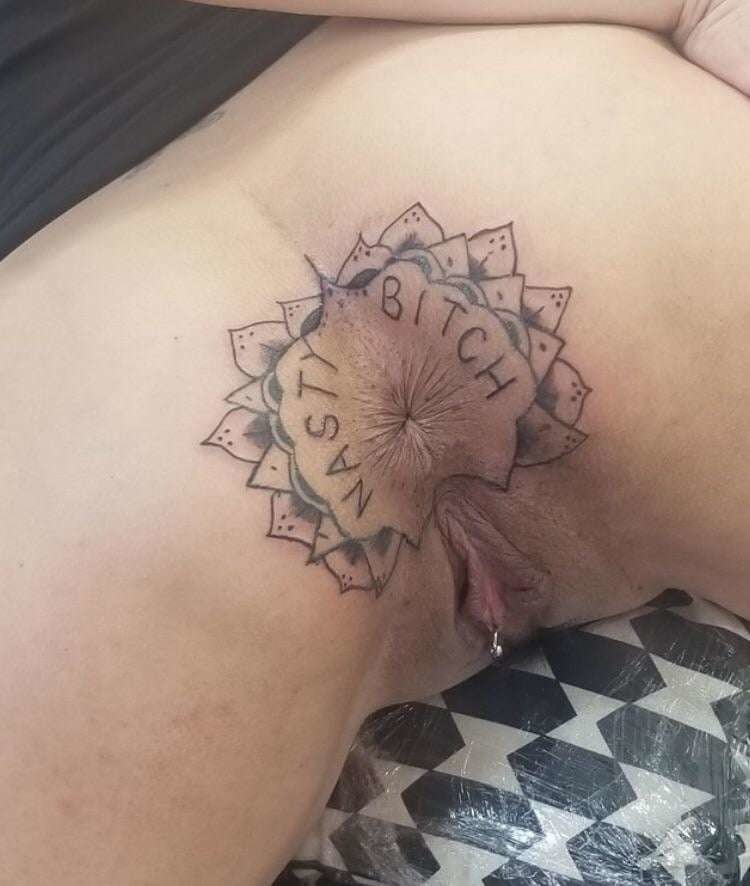 asshole