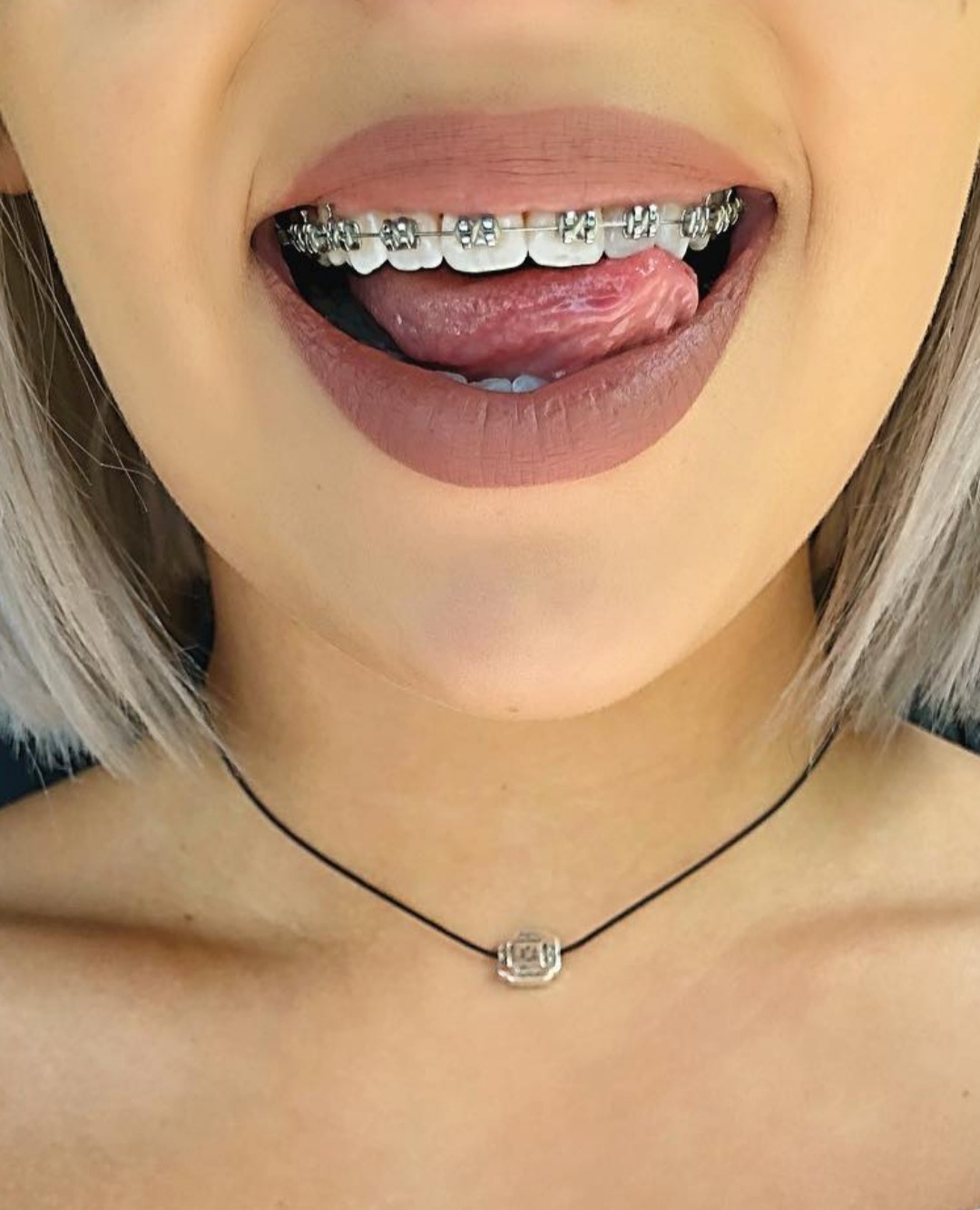 Tongue