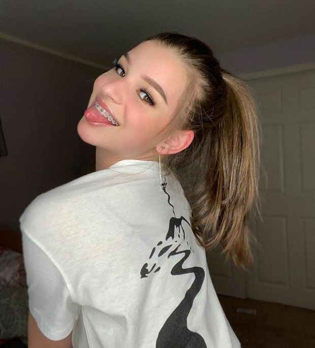 Braceface