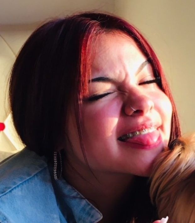 Braces