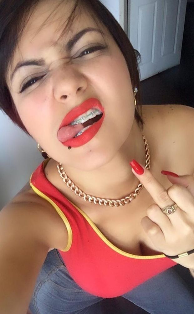 Braces fuck you