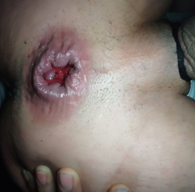 Asshol my love