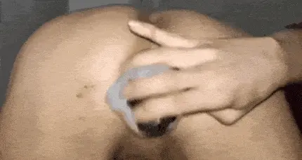 My anal big gaped