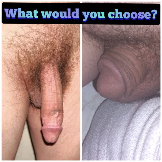 You choose