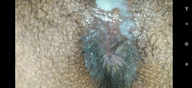 PNG teen dirty asshole