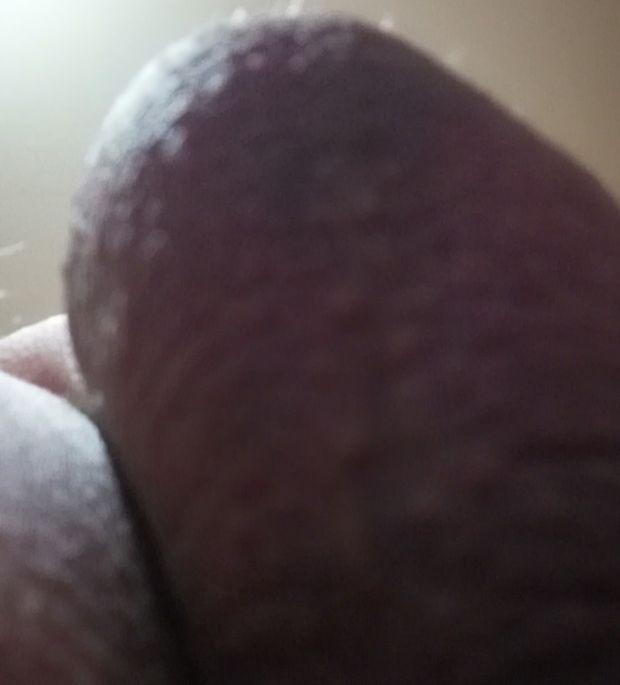 Me balls