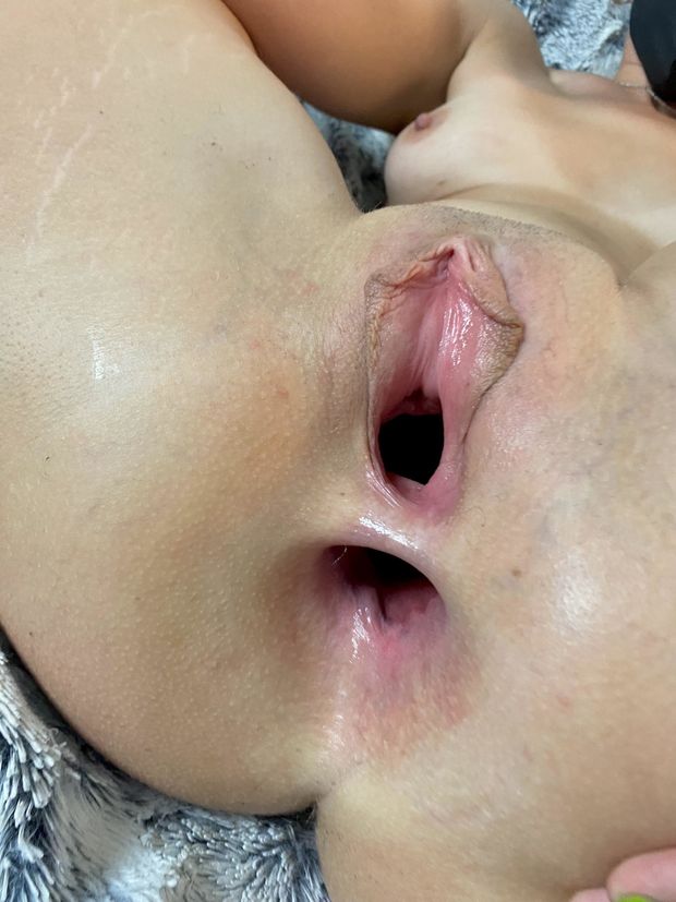 total opening
