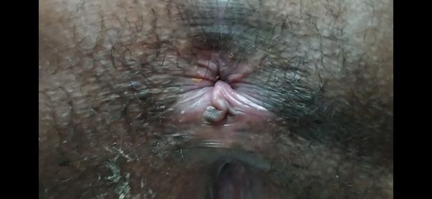 PNG Teen displays dirty and shitty asshole