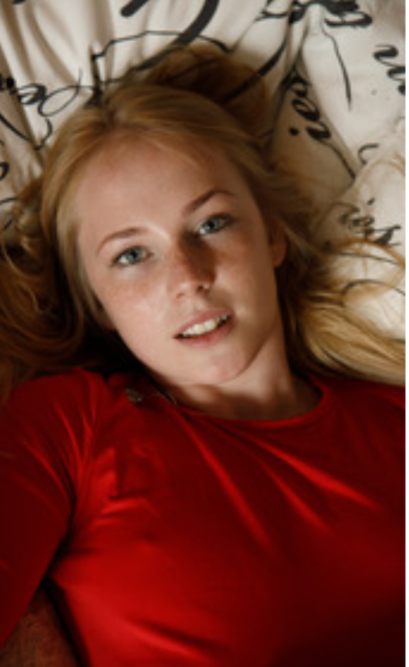 Freckles