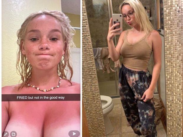 Burnt