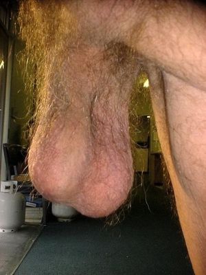 Hairy balls