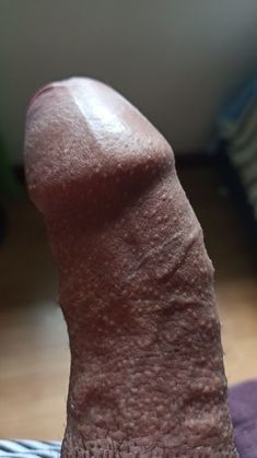 :P