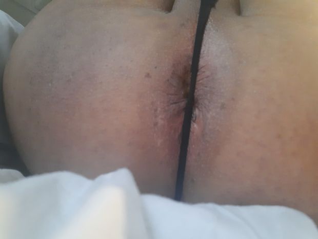 Big hole