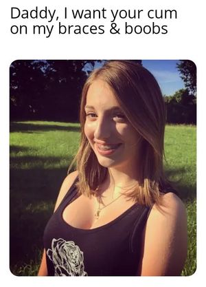 Trin Daddy braces and boobs