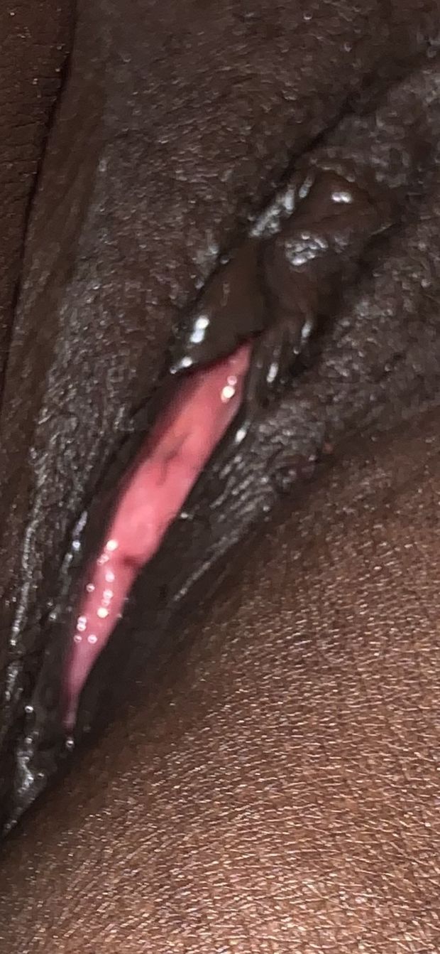Snack