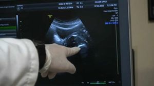 breast examination and kegel exercises of the vagina revisión mamas y ejercicios de kegel