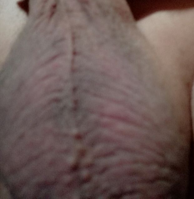 Me balls