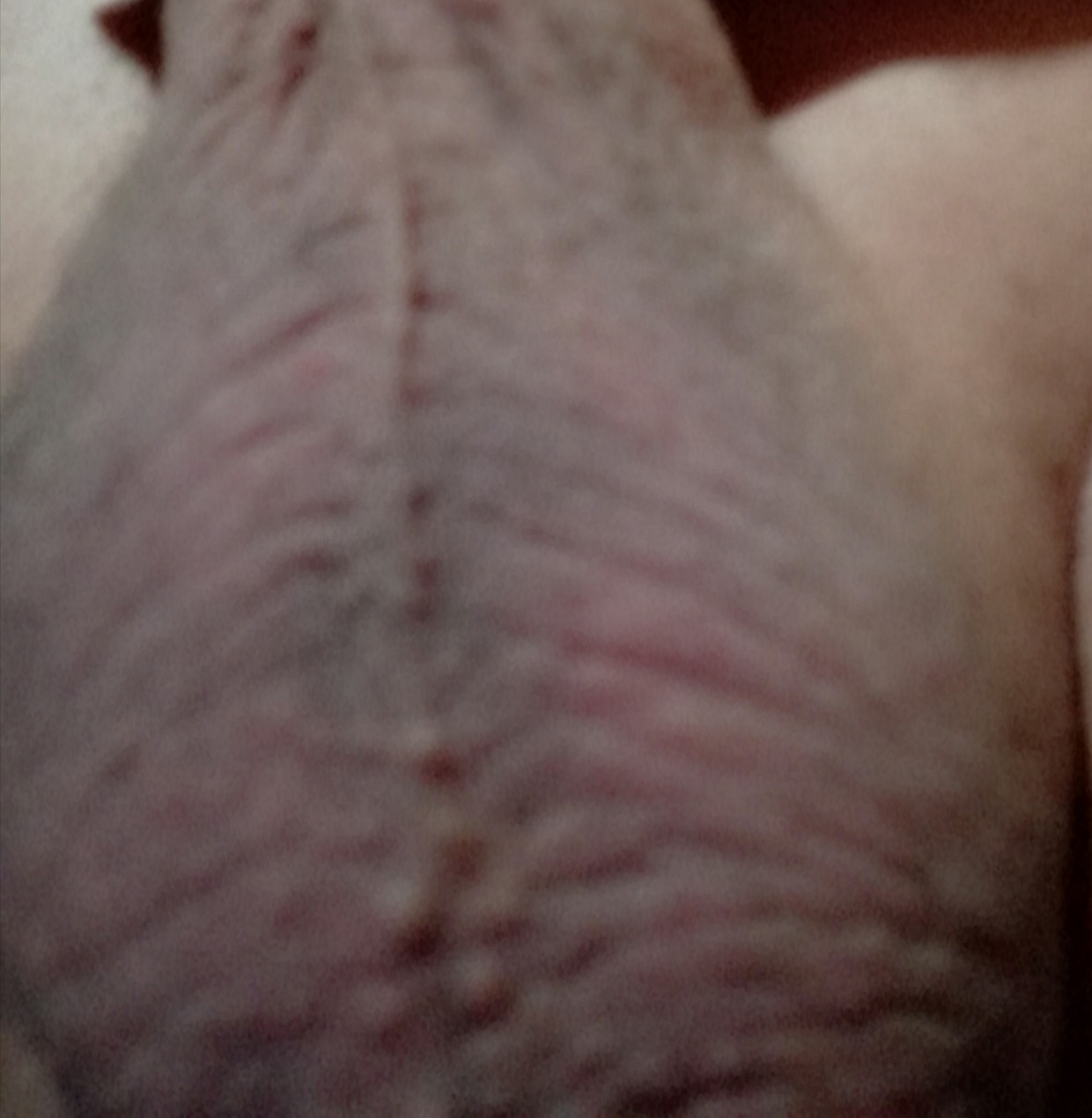 Me balls