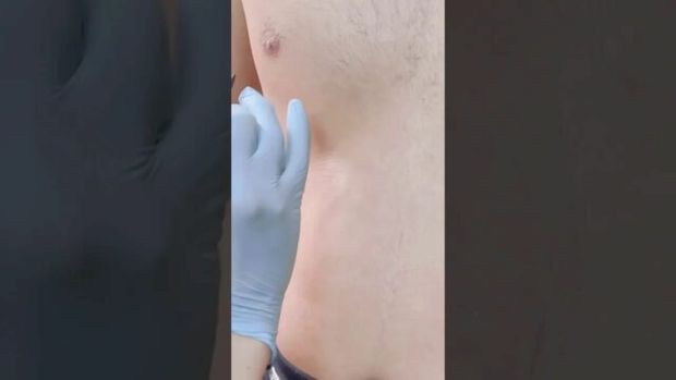 nipple piercing
