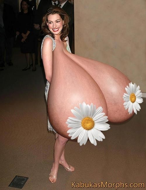 Anne H. Flopping Her Massive Boobs In Front Of People