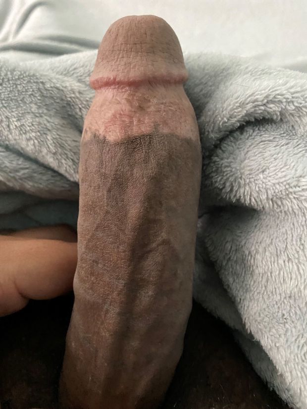 Morning wood