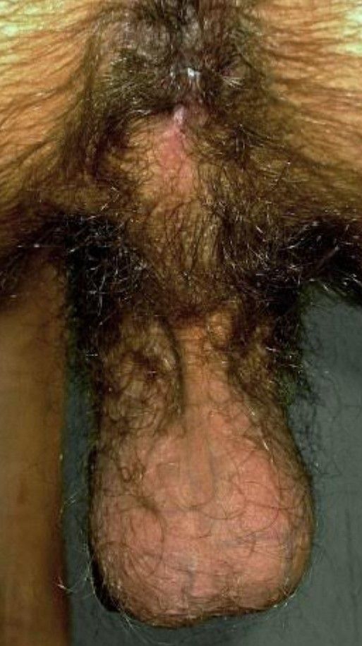 Hairy ass + balls