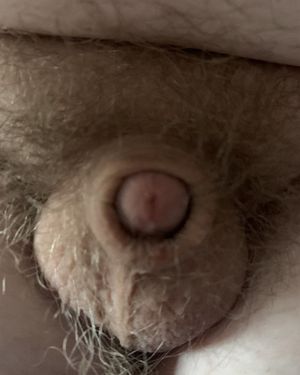 Look at my micropenis