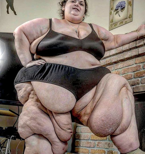 Horrible fat woman