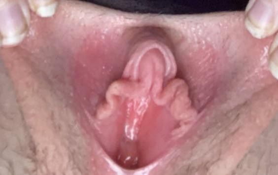 Exposed slut 5